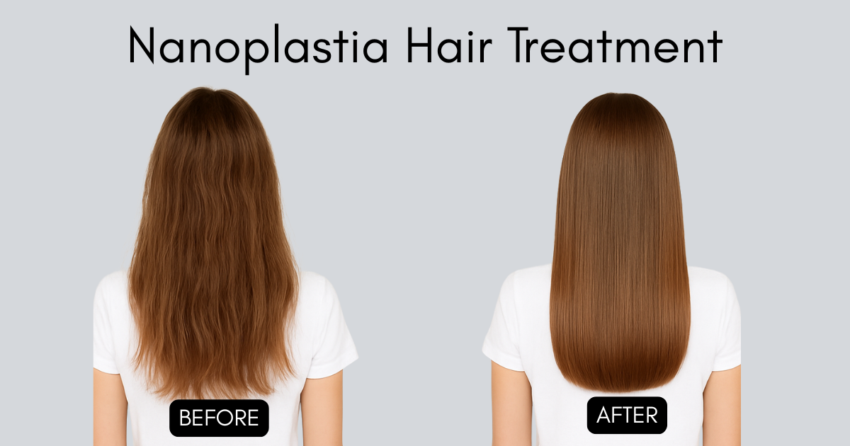  Nanoplastia Hair Treatment In Delhi, Noida, Gurgaon, Ghaziabad & Faridabad – Smooth & Frizz-free Hair Near Me